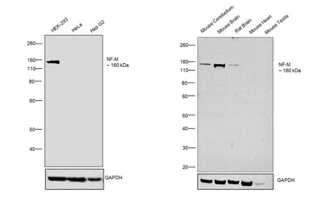 NEFM Antibody in Western Blot (WB)