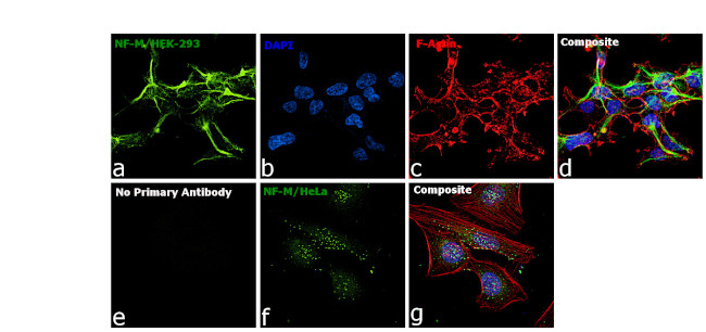 NEFM Antibody in Immunocytochemistry (ICC/IF)