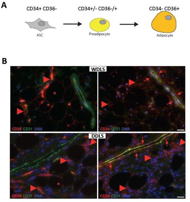 CD36 Antibody in Immunohistochemistry (IHC)