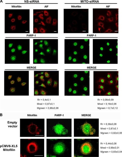 Mitofilin Antibody in Immunocytochemistry (ICC/IF)