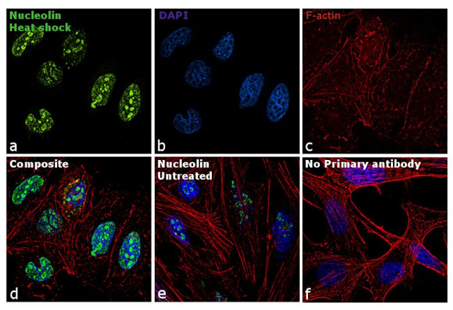 Nucleolin Antibody in Immunocytochemistry (ICC/IF)