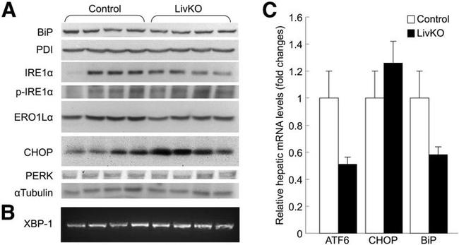 Phospho-IRE1 alpha (Ser724) Antibody in Western Blot (WB)