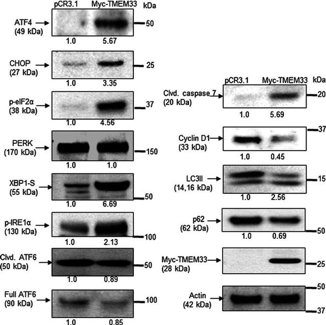 Phospho-IRE1 alpha (Ser724) Antibody in Western Blot (WB)