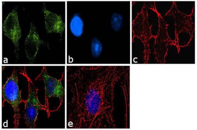 ATG9A Antibody in Immunocytochemistry (ICC/IF)