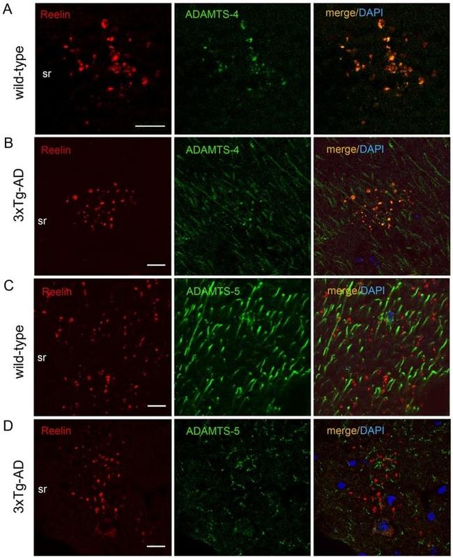 ADAMTS4 Antibody in Immunohistochemistry (IHC)