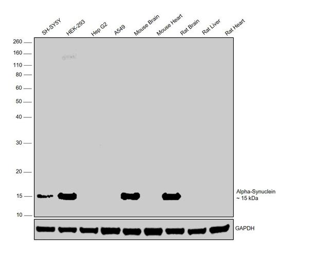 alpha Synuclein Antibody in Western Blot (WB)