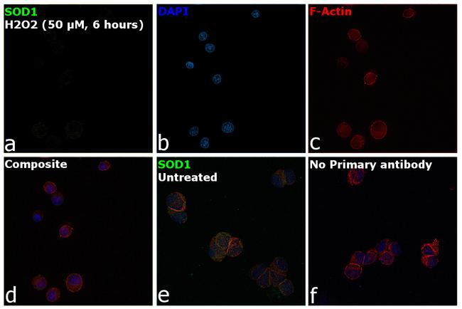 SOD1 Antibody