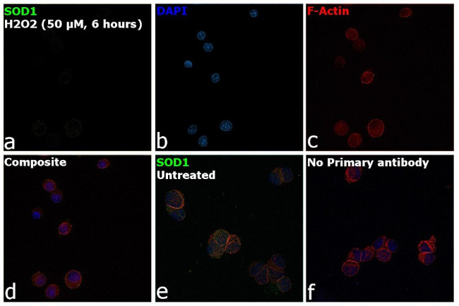 SOD1 Antibody in Immunocytochemistry (ICC/IF)
