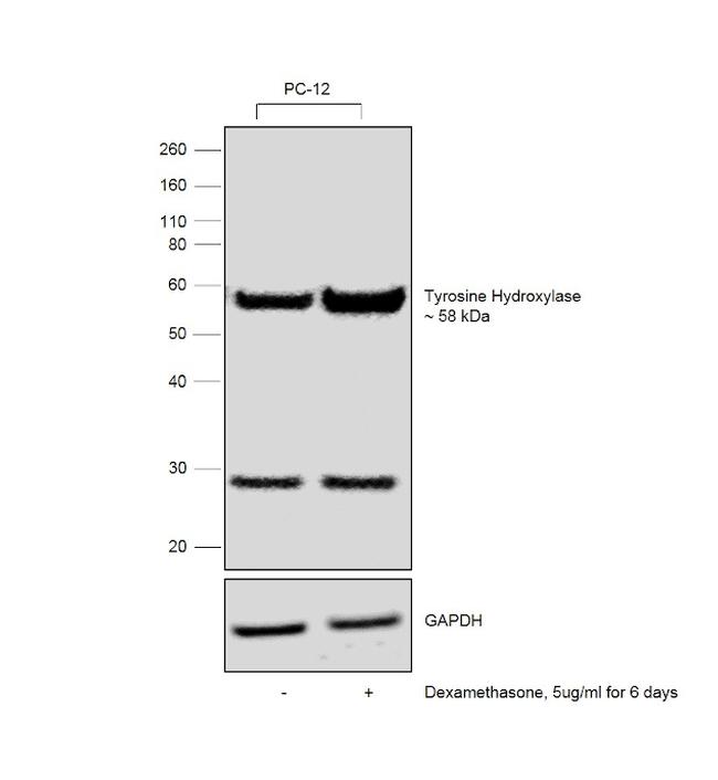 Tyrosine Hydroxylase Antibody in Western Blot (WB)