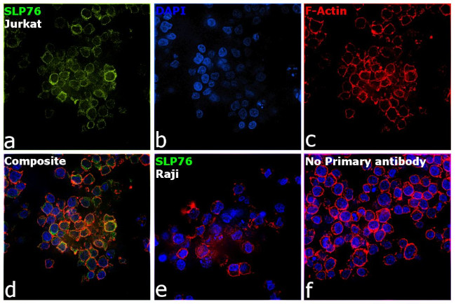 SLP76 Antibody in Immunocytochemistry (ICC/IF)