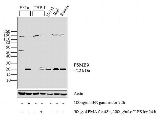 PSMB9 Antibody in Western Blot (WB)