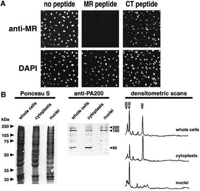 PSME4 Antibody in Western Blot (WB)