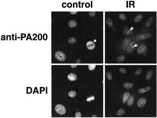 PSME4 Antibody in Immunocytochemistry (ICC/IF)