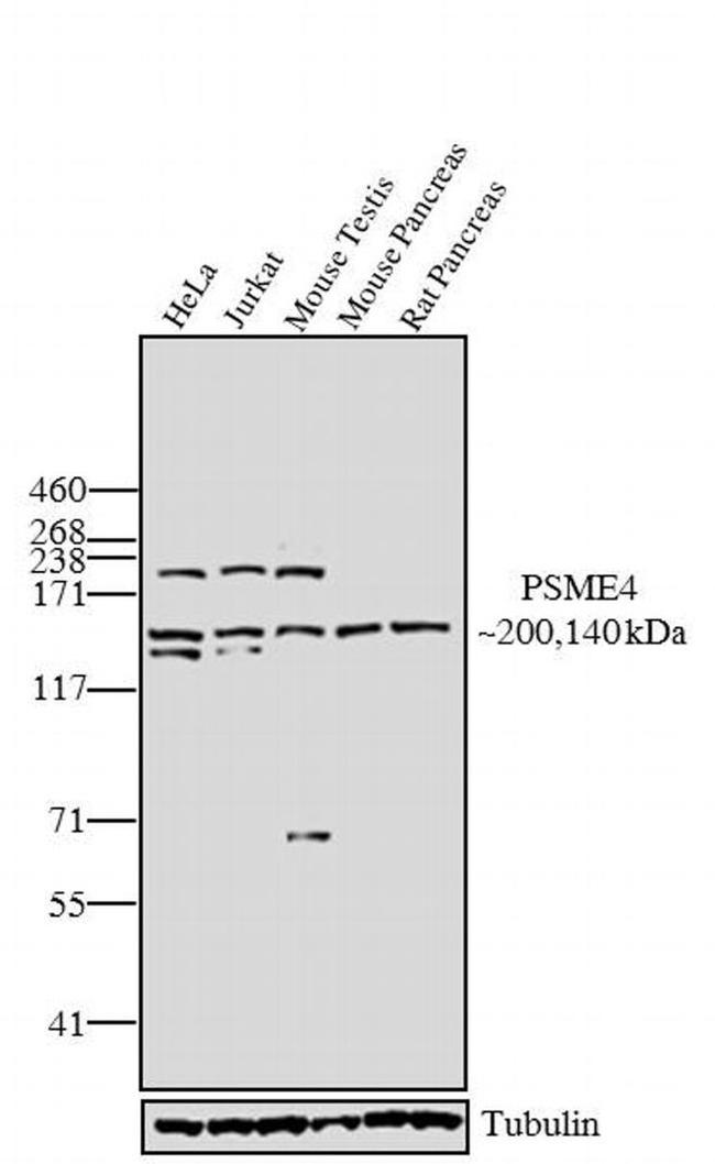 PSME4 Antibody in Western Blot (WB)