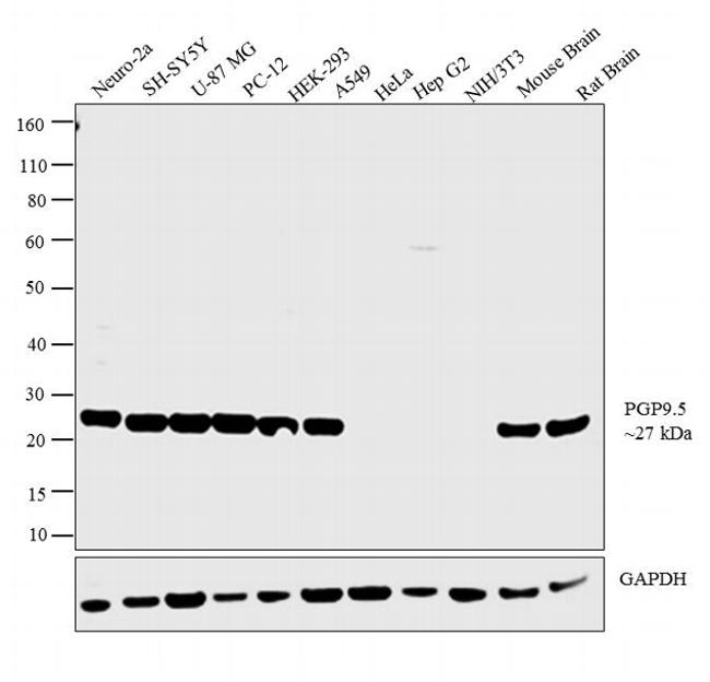 PGP9.5 Antibody in Western Blot (WB)