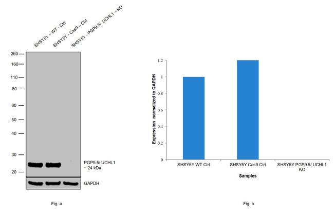 PGP9.5 Antibody in Western Blot (WB)