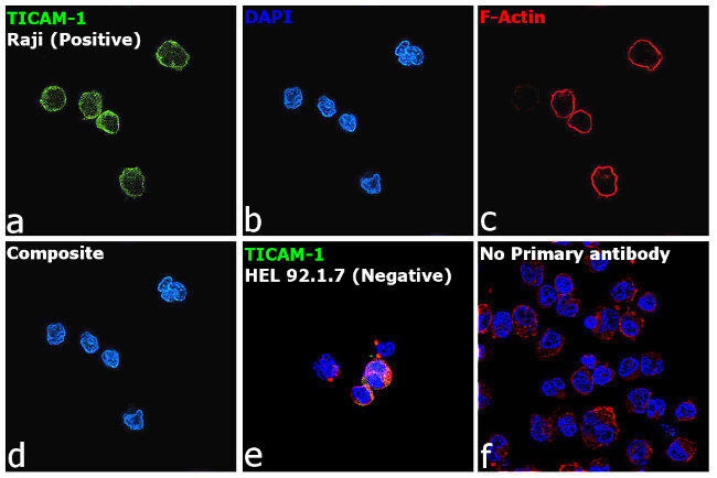 TRIF Antibody in Immunocytochemistry (ICC/IF)