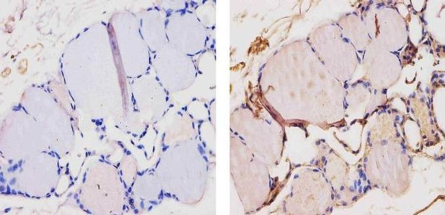 THRA Antibody in Immunohistochemistry (Paraffin) (IHC (P))