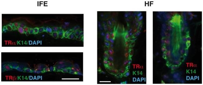 THRB Antibody in Immunohistochemistry (Paraffin) (IHC (P))