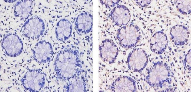 THRB Antibody in Immunohistochemistry (Paraffin) (IHC (P))