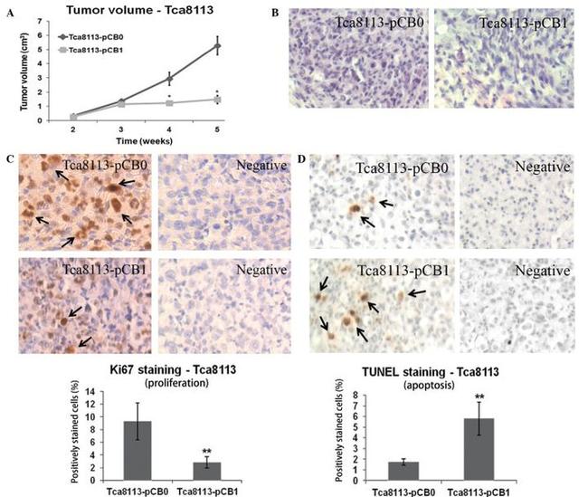 Ki-67 Antibody in Immunohistochemistry (IHC)