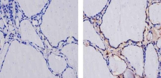 THRA Antibody in Immunohistochemistry (Paraffin) (IHC (P))