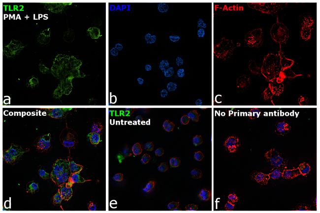 TLR2 Antibody