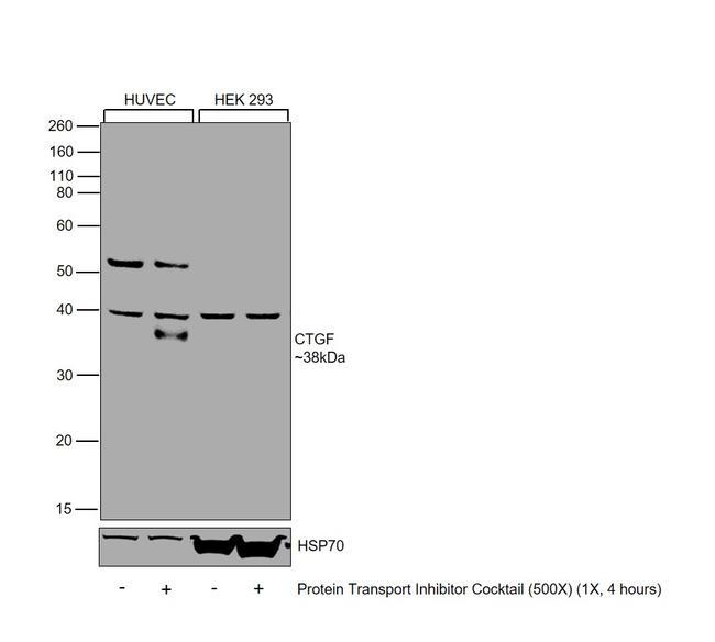 CTGF Antibody in Western Blot (WB)