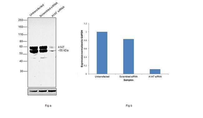 alpha-1 Antitrypsin Antibody in Western Blot (WB)