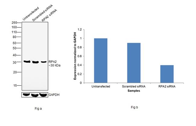 RPA2 Antibody in Western Blot (WB)