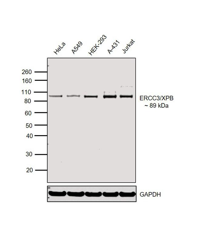 XPB Antibody in Western Blot (WB)