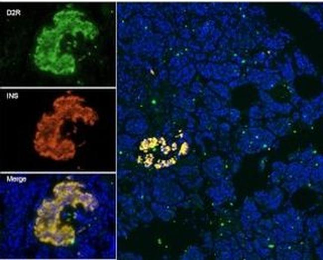 DRD2 Antibody in Immunohistochemistry (IHC)