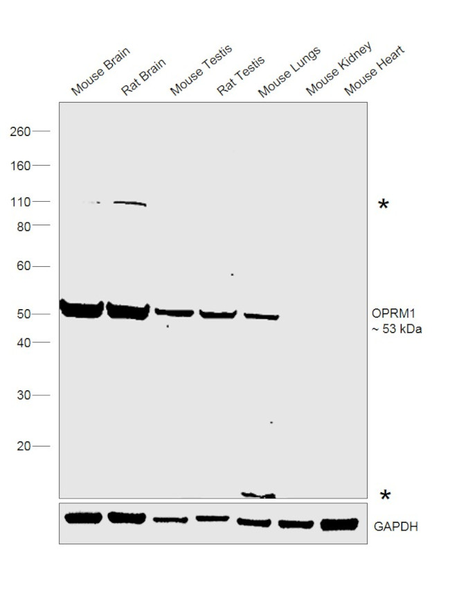 OPRM1 Antibody