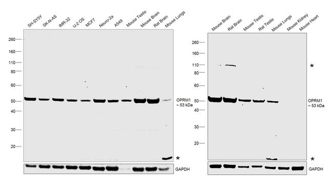 OPRM1 Antibody in Western Blot (WB)