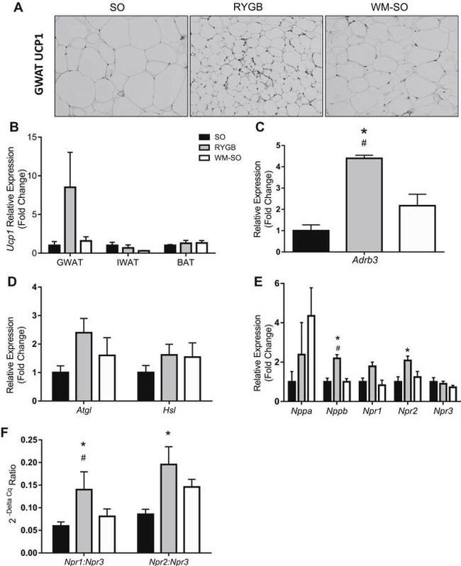 UCP1 Antibody in Immunohistochemistry (Paraffin) (IHC (P))