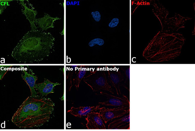 Cofilin Antibody in Immunocytochemistry (ICC/IF)