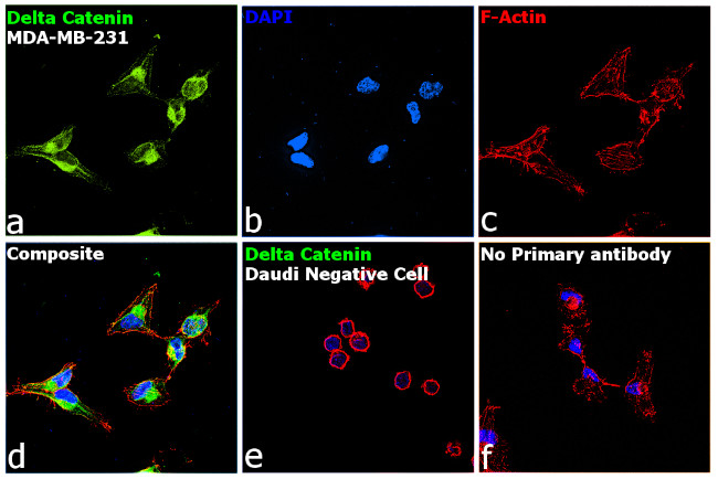 delta Catenin Antibody in Immunocytochemistry (ICC/IF)