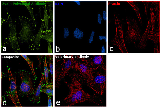 Zyxin Antibody in Immunocytochemistry (ICC/IF)