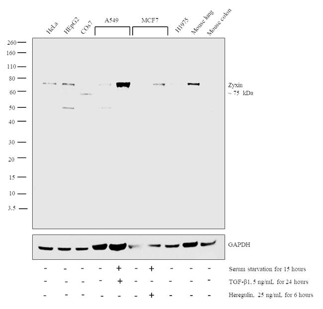 Zyxin Antibody in Western Blot (WB)