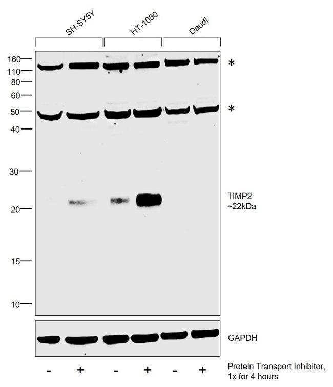 TIMP2 Antibody in Western Blot (WB)