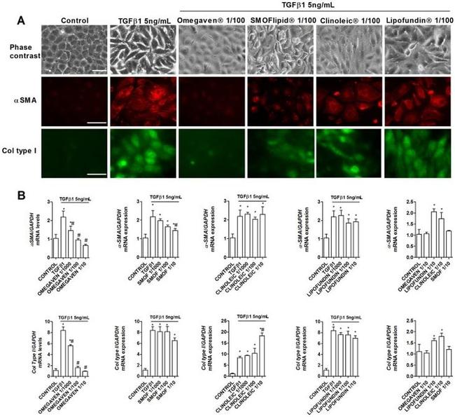 Collagen I Antibody in Immunocytochemistry (ICC/IF)