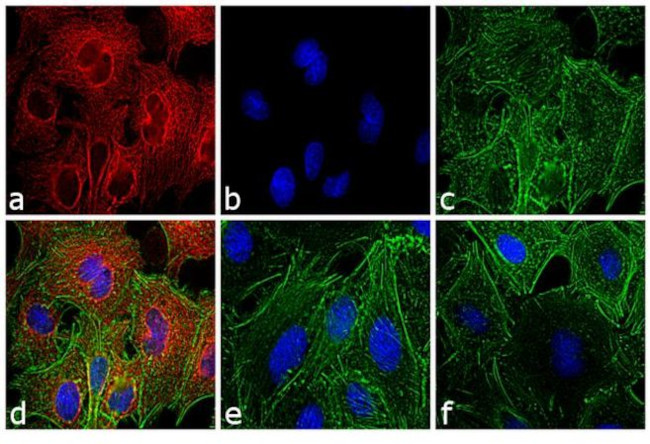 Rat IgG (H+L) Secondary Antibody in Immunocytochemistry (ICC/IF)