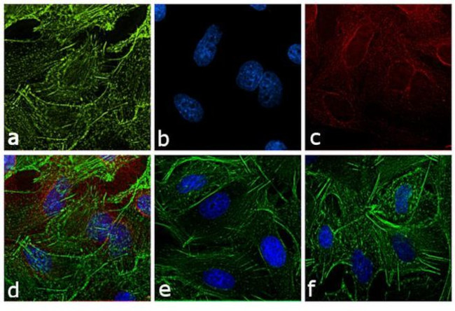 Rat IgG (H+L) Secondary Antibody in Immunocytochemistry (ICC/IF)