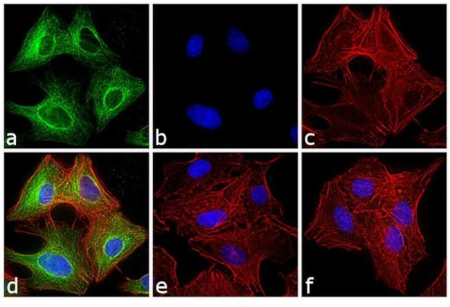 Rat IgG (H+L) Secondary Antibody in Immunocytochemistry (ICC/IF)