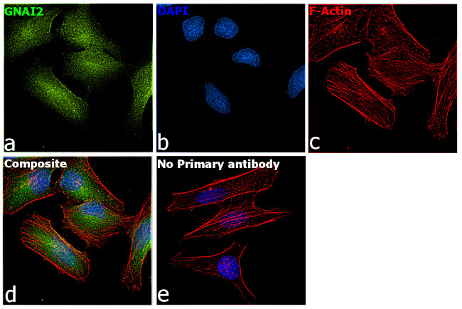 GNAI2 Antibody in Immunocytochemistry (ICC/IF)