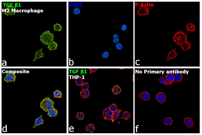 TGF beta-1 Antibody in Immunocytochemistry (ICC/IF)