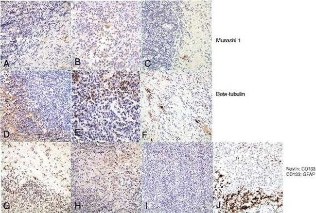 beta Tubulin Antibody in Immunohistochemistry (IHC)