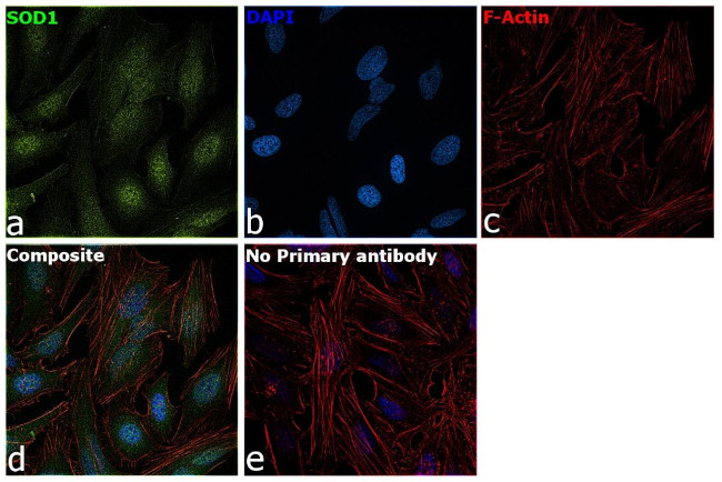 SOD1 Antibody in Immunocytochemistry (ICC/IF)