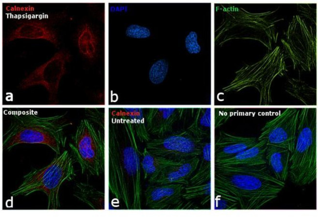 Calnexin Antibody in Immunocytochemistry (ICC/IF)