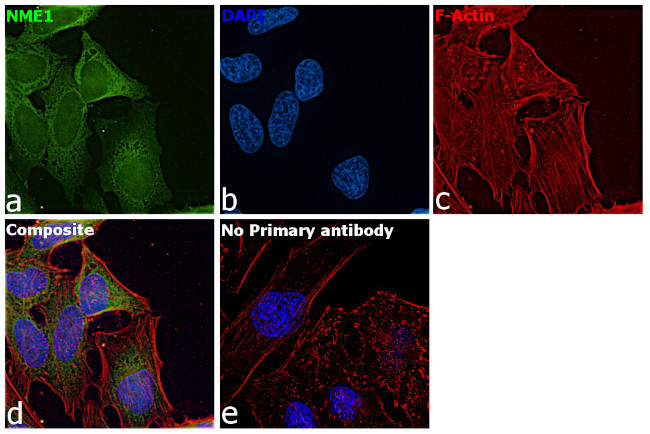 ENO1 Antibody in Immunocytochemistry (ICC/IF)